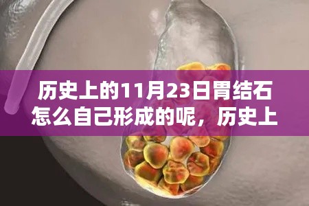 历史上的11月23日，胃结石成因深度探讨与解析