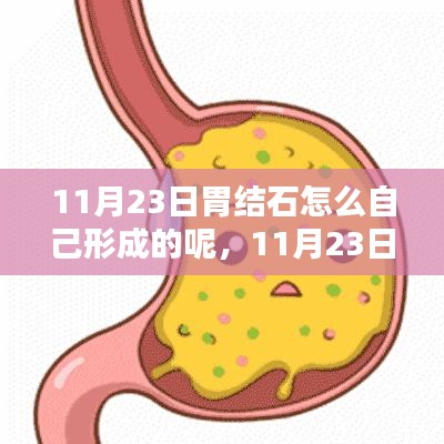 深度解析，11月23日胃结石成因、特性及自我形成机制