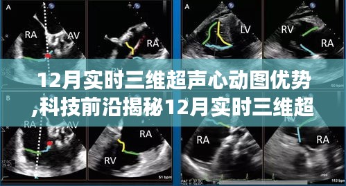 揭秘科技前沿，实时三维超声心动图的健康赋能与重塑心动时刻